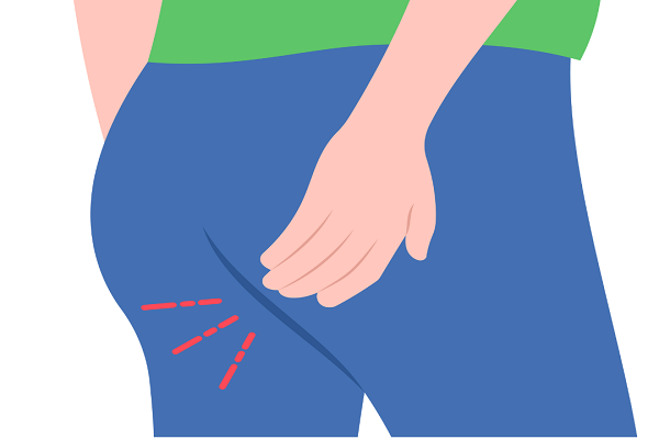 Best Piles Treatment in Delhi