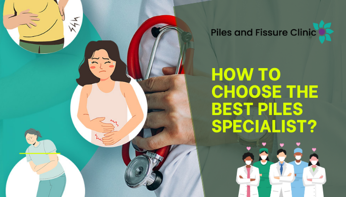 How to Choose the Best Specialists for Piles Treatment?