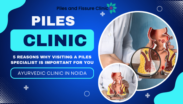 Piles doctor in Noida