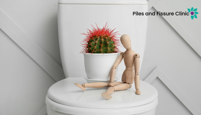 Top 7 Effective Ways to Treat Piles at Home
