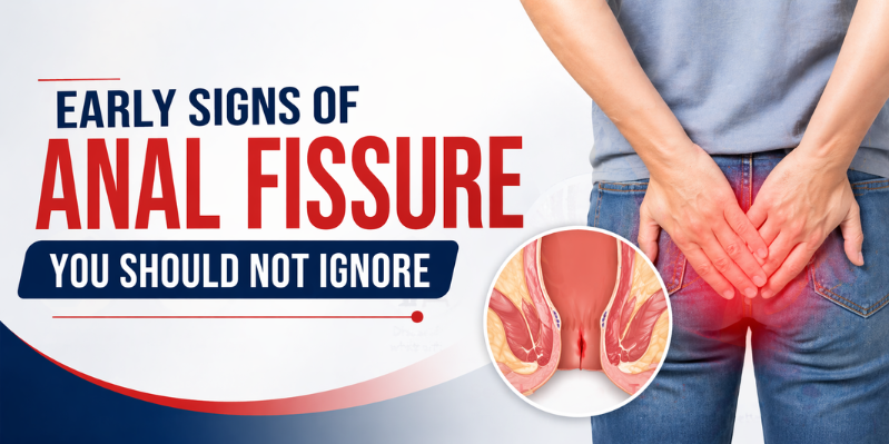 Early Signs of Anal Fissure You Should Not Ignore