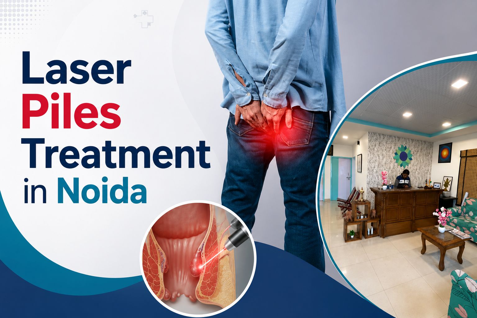 Laser Piles Treatment in Noida